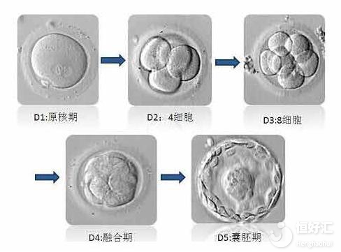 美國試管嬰兒對胚胎移植數量有要求嗎？