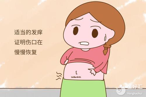 剖腹產孕媽注意了！產后這樣護理助你快速恢復