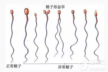 試管嬰兒畸形率高嗎？這2點才是“不為人知”的一面