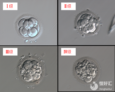 3分鐘看懂試管胚胎等級區(qū)分，有利提高成功率！