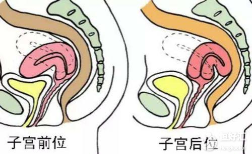 子宮后位很難懷孕嗎？醫(yī)生：掌握這兩點(diǎn)輕松受孕