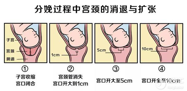 宮口開指是什么？攜你一起了解宮口開指的那些事兒