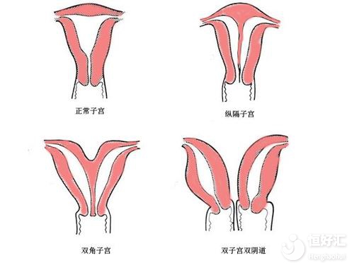 子宮偏小能懷上寶寶嗎？看完或許會嚇一跳