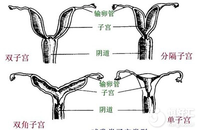 單角子宮和雙角子宮是一樣的嗎？這2點是最大區別