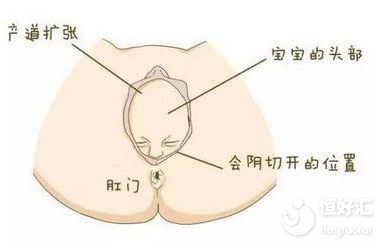 會陰切除聽著都怕？做好這些讓你避免切除的命運