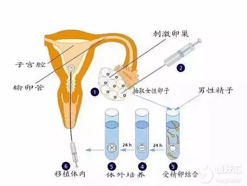 試管嬰兒取卵需要多長(zhǎng)時(shí)間？或許沒(méi)你想的復(fù)雜