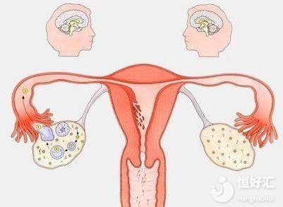 這就卵巢早衰了？中醫治療如何改善卵巢功能？