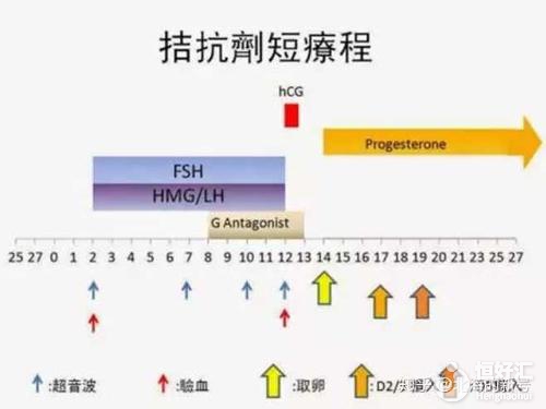 試管拮抗劑方案是什么？醫生：這些人適合應用