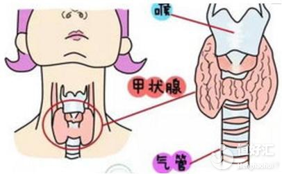 試管嬰兒為什么要查甲狀腺功能？醫生：圖的是這個