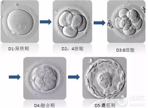  試管嬰兒胚胎等級如何劃分？花三分鐘看懂