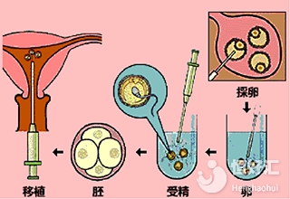 做試管精子和卵子不能在體外受精？說出來你別不信