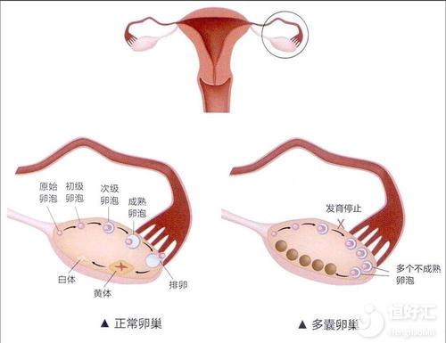 多囊備孕什么時候可以促排卵？這個時間你想不到