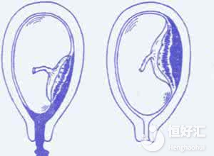 你知道保胎針有什么作用嗎？這3點相信你了解過