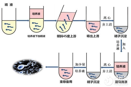 試管嬰兒會變胖加速衰老？最新辟謠來了