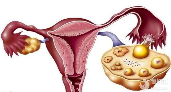 多囊卵巢做試管需掌握這些步驟，別錯(cuò)過了