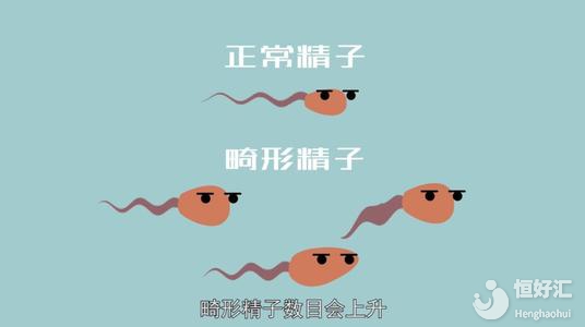 精子畸形的表現(xiàn)與治療，你先了解哪一個(gè)？