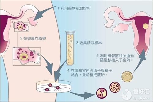 你知道做試管最難過的是哪一關嗎？這個很明顯