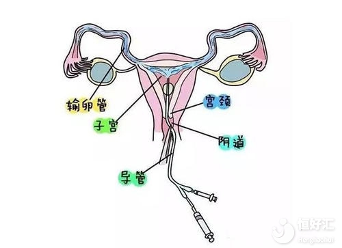 不孕檢查的最佳時(shí)間你知道嗎？快看這里