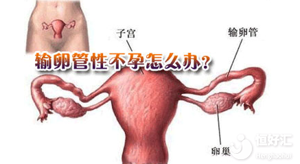 輸卵管性不孕怎么辦