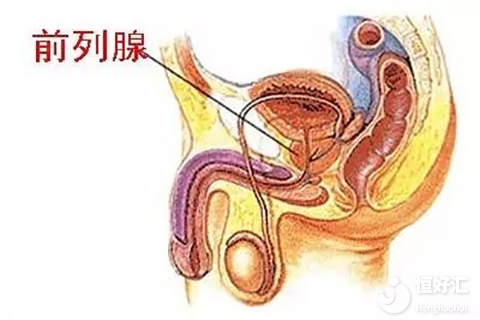 男方有前列腺炎會影響試管受孕嗎？