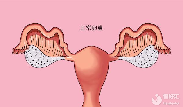 卵巢早衰怎么保護