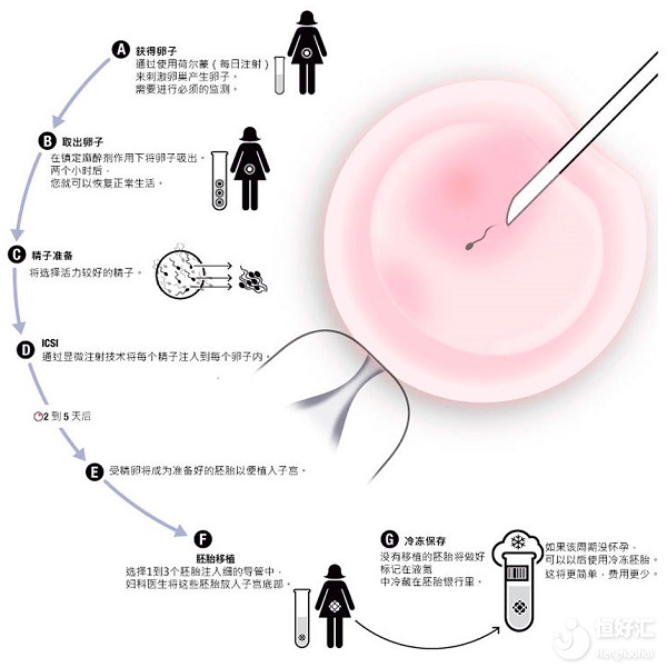 廣州做試管嬰兒過程中，為什么有的人一個卵子都取不到？取卵老是失敗？