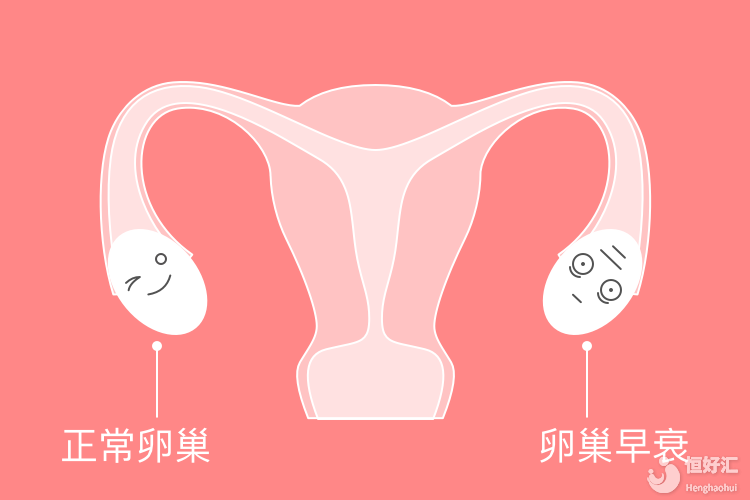 人未老，卵巢先衰，卵巢早衰應(yīng)該怎么調(diào)理？