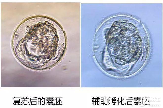 馬來西亞試管嬰兒醫院科普：為什么胚胎冷凍多年解凍后仍可使用？